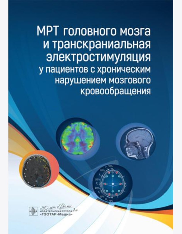 МРТ головного мозга и транскраниальная электростимуляция у пациентов с хроническим нарушением мозгового кровообращения