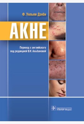 Акне