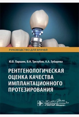 Рентгенологическая оценка качества имплантационного протезирования: руководство для врачей