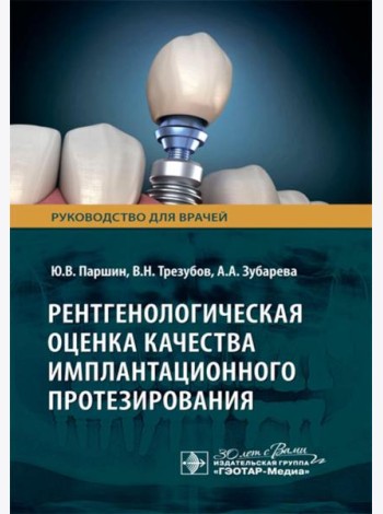 Рентгенологическая оценка качества имплантационного протезирования: руководство для врачей
