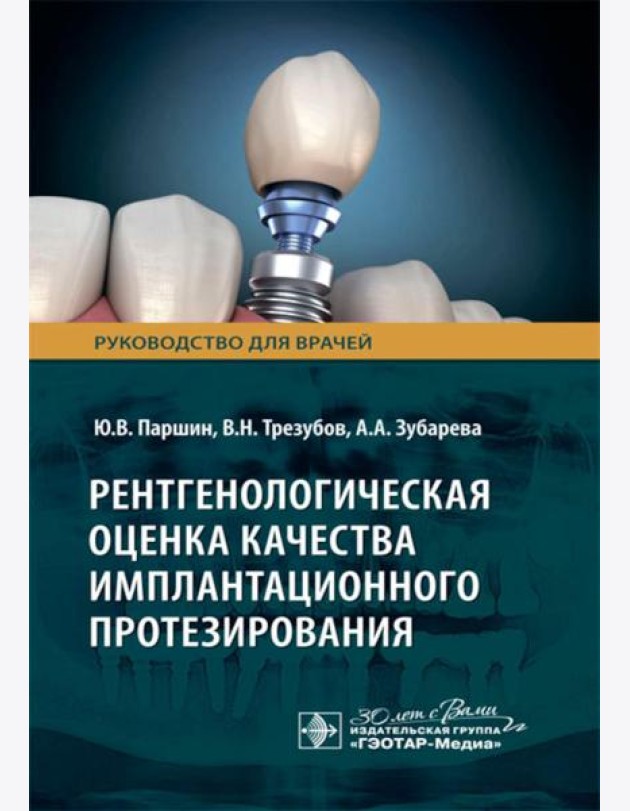 Рентгенологическая оценка качества имплантационного протезирования: руководство для врачей