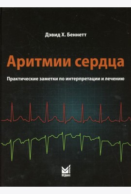 Аритмии сердца. Практические заметки по интерпретации и лечению