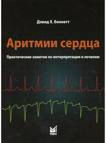 Аритмии сердца. Практические заметки по интерпретации и лечению