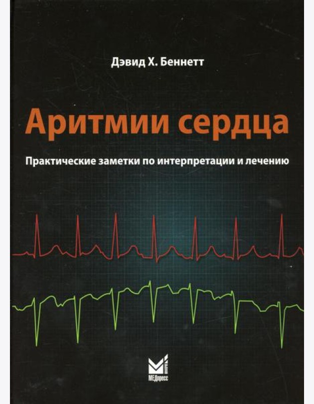 Аритмии сердца. Практические заметки по интерпретации и лечению