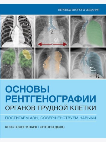 Основы рентгенографии органов грудной клетки