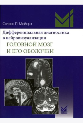 Дифференциальная диагностика в нейровизуализации. Головной мозг и его оболочки