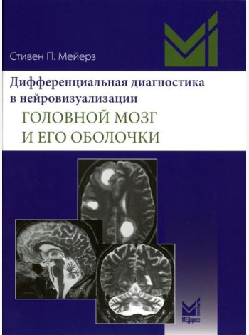 Дифференциальная диагностика в нейровизуализации. Головной мозг и его оболочки