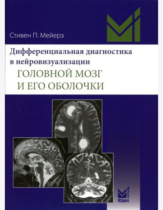 Дифференциальная диагностика в нейровизуализации. Головной мозг и его оболочки