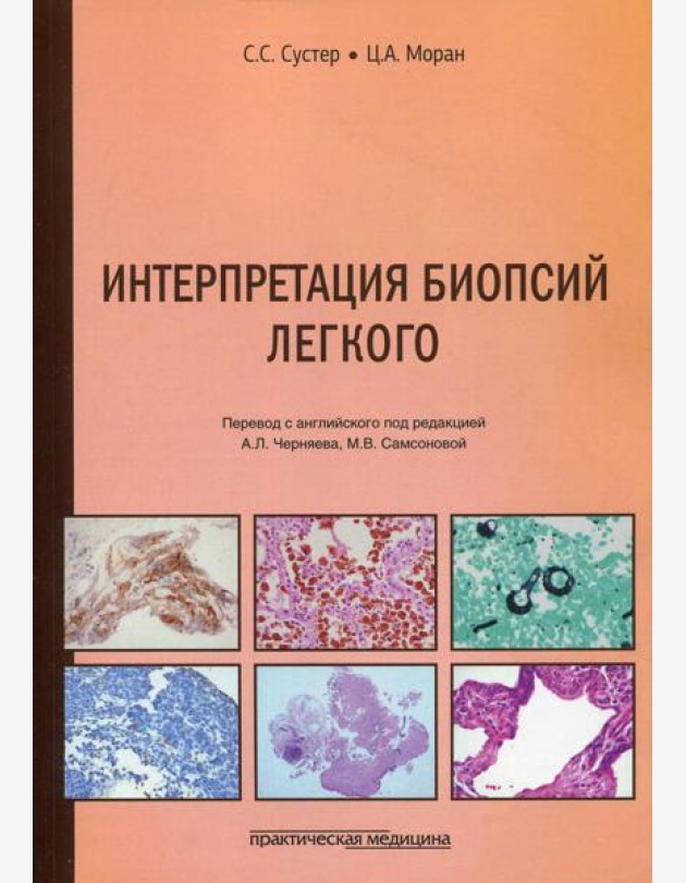 Интерпретация биопсий легкого