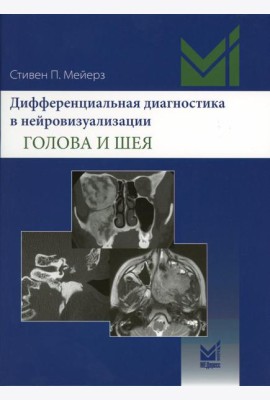 Дифференциальная диагностика в нейровизуализации. Голова и шея
