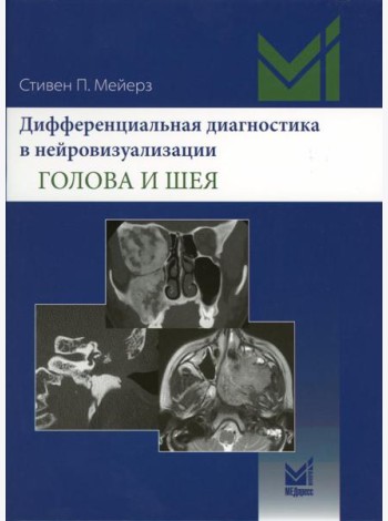Дифференциальная диагностика в нейровизуализации. Голова и шея