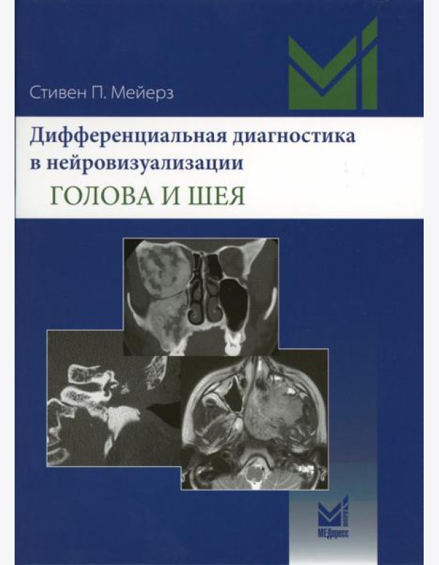Дифференциальная диагностика в нейровизуализации. Голова и шея