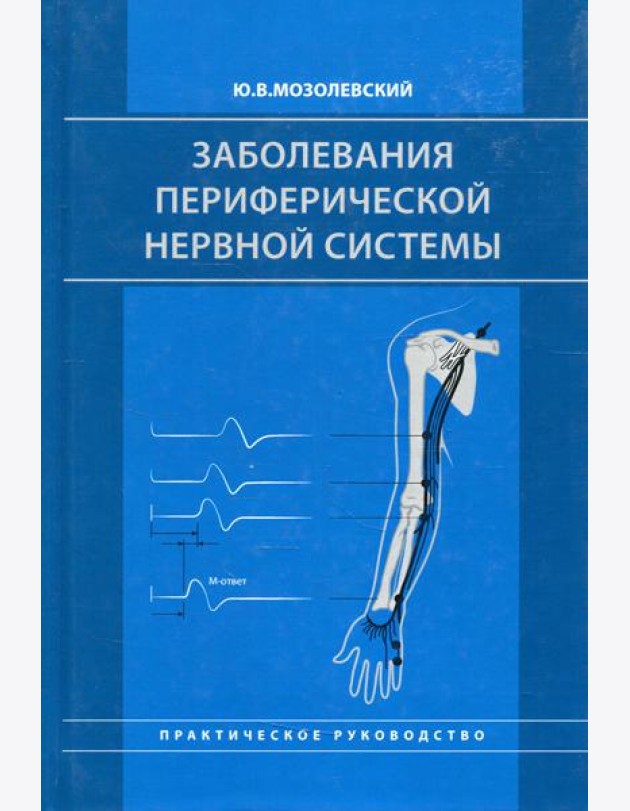 Заболевания периферической нервной системы. Практическое руководство