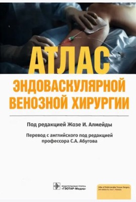 Атлас эндоваскулярной венозной хирургии