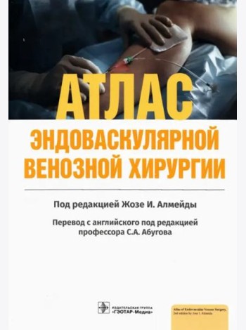 Атлас эндоваскулярной венозной хирургии