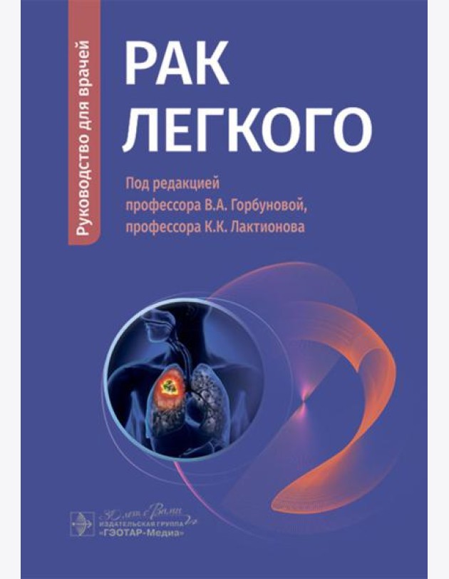 Рак легкого: руководство для врачей