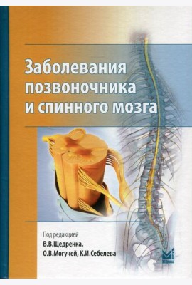 Заболевания позвоночника и спинного мозга.