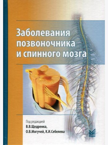Заболевания позвоночника и спинного мозга.