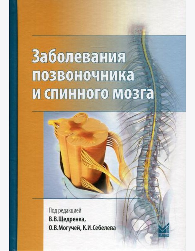 Заболевания позвоночника и спинного мозга.