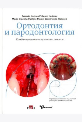 Ортодонтия и пародонтология. Комбинированные стратегии лечения