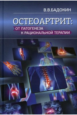 Остеоартрит: от патогенеза к рациональной терапии