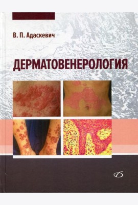 Дерматовенерология