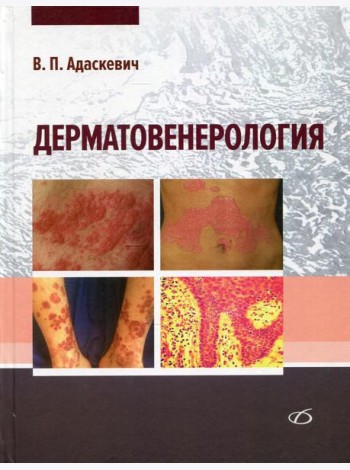 Дерматовенерология