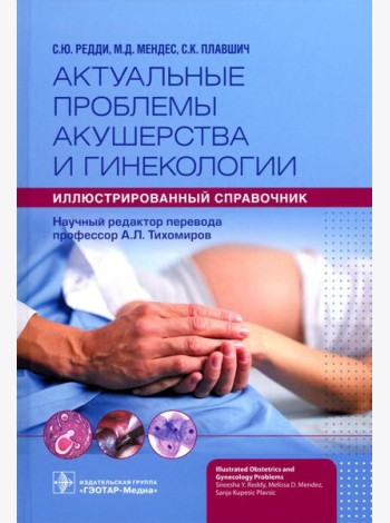 Актуальные проблемы акушерства и гинекологии: иллюстрированный справочник