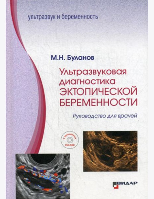 Ультразвуковая диагностика эктопической беременности: Руководство для врачей: с приложением DVD-ROM