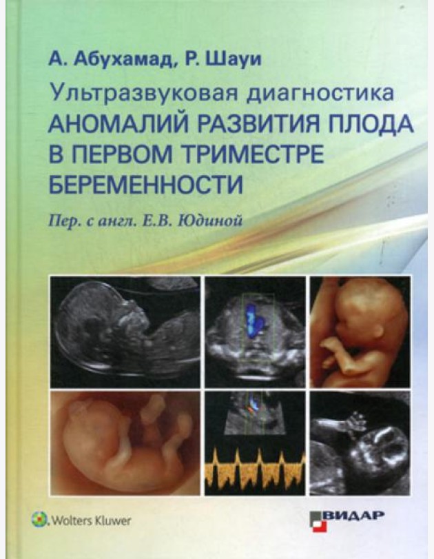 Ультразвуковая диагностика аномалий развития плода в первом триместре беременности