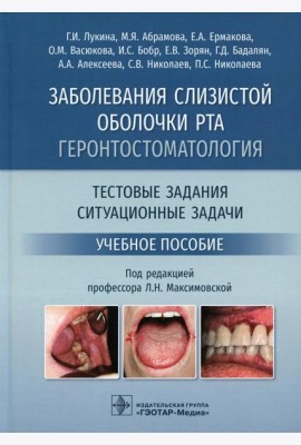 Заболевания слизистой оболочки рта. Геронтостоматология. Тестовые задания, ситуационные задачи: Учебное пособие