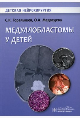 Медуллобластомы у детей