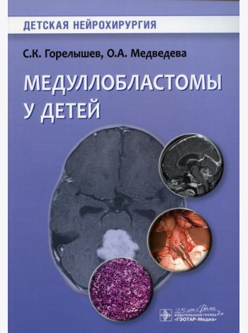 Медуллобластомы у детей