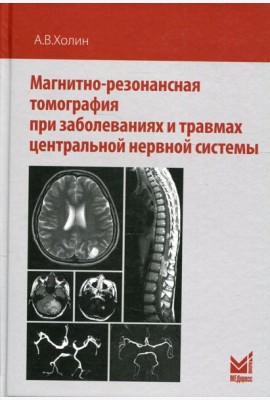 Магнитно-резонансная томография при заболеваниях и травмах центральной нервной системы. 2-е изд