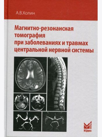Магнитно-резонансная томография при заболеваниях и травмах центральной нервной системы. 2-е изд