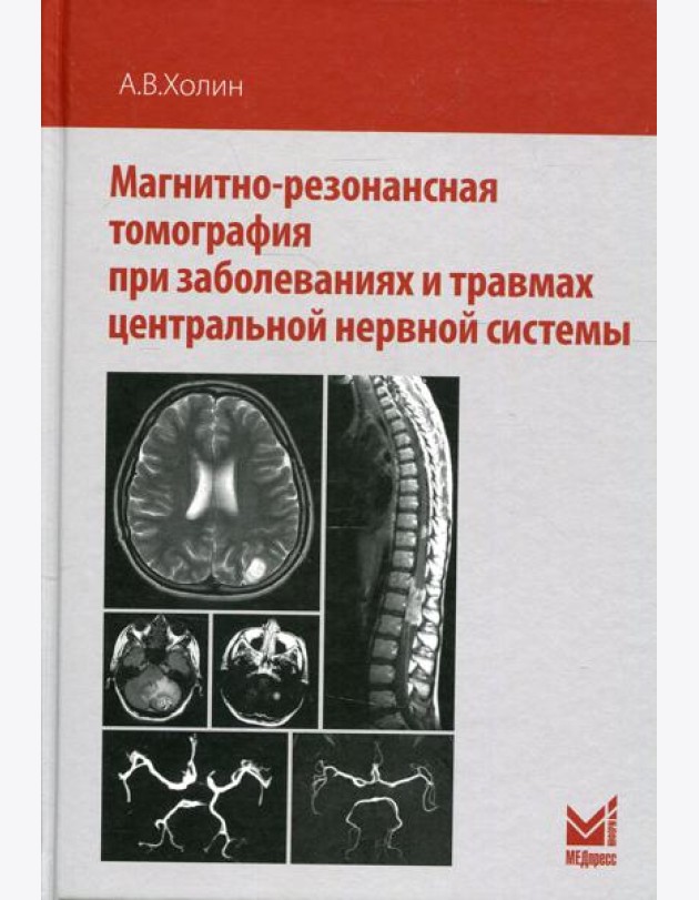 Магнитно-резонансная томография при заболеваниях и травмах центральной нервной системы. 2-е изд