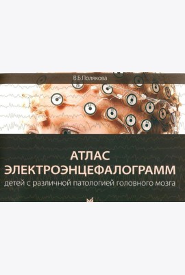 Атлас электроэнцефалограмм детей с различной патологией головного мозга. 2-е изд