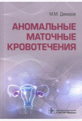 Аномальные маточные кровотечения