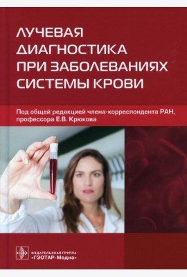 Лучевая диагностика при заболеваниях системы крови
