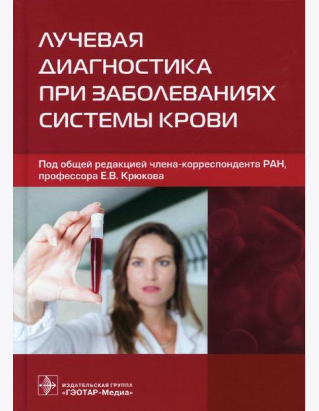 Лучевая диагностика при заболеваниях системы крови