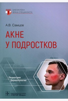 Акне у подростков