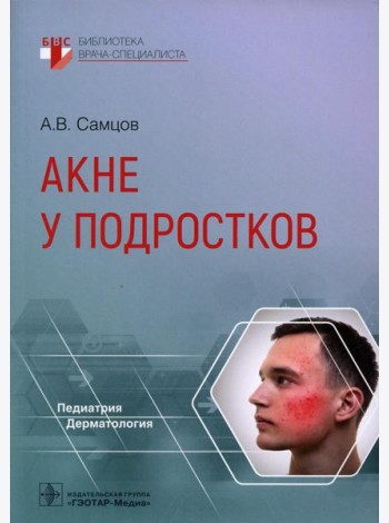 Акне у подростков
