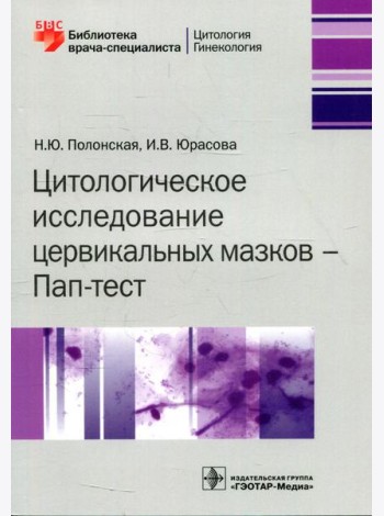 Цитологическое исследование цервикальных мазков - Пап-тест
