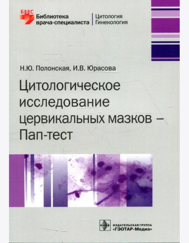 Цитологическое исследование цервикальных мазков - Пап-тест