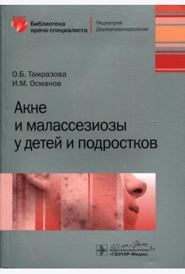 Акне и малассезиозы у детей и подростков