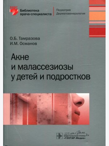 Акне и малассезиозы у детей и подростков