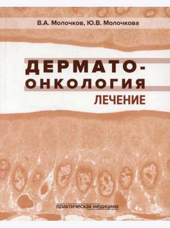 Дерматоонкология. Лечение
