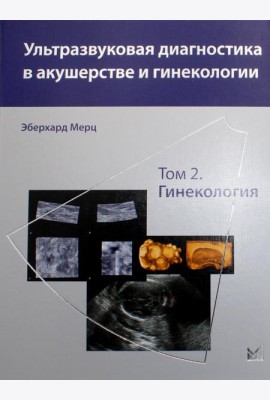 Ультразвуковая диагностика в акушерстве и гинекологии: В 2 т. Т. 2: Гинекология. 2-е изд