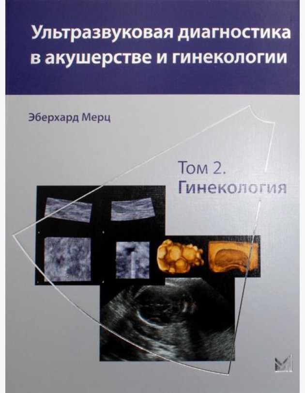 Ультразвуковая диагностика в акушерстве и гинекологии: В 2 т. Т. 2: Гинекология. 2-е изд