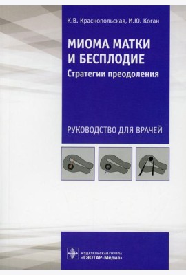 Миома матки и бесплодие: стратегии преодоления: руководство для врачей
